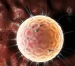 Fertilização In-Vitro Convencional (FIV) - óvulos e o preparo seminal, ambos são colocados em contato em um mesmo local, para que ocorra a penetração "naturalmente" do espermatozóide no óvulo