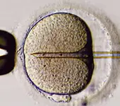 Injeção Intracitoplasmática de Espermatozóide (ICSI) - Após a injeção, os óvulos são colocados em uma placa com meio de cultura dentro de uma incubadora.
