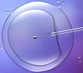 Injeção Intracitoplasmática de Espermatozóide (ICSI) - O espermatozoide selecionado será injetados, dentro do óvulo, sendo injetado apenas 1 espermatozóide em cada óvulo.